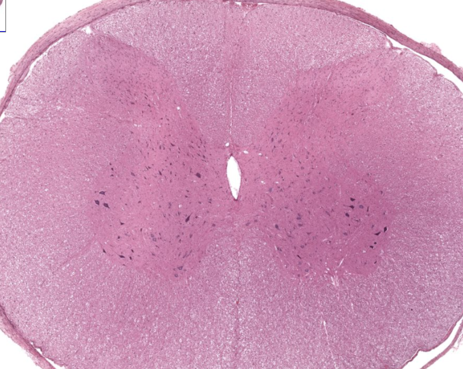 <p>butterfly shaped region that contain nerve cell bodies and supporting glial cells </p>