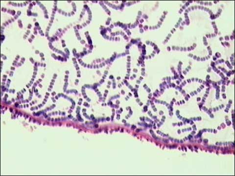 Gram negative, form long filaments, photosynthetic, macroscopic colonies, form heterocysts in low nitrogen