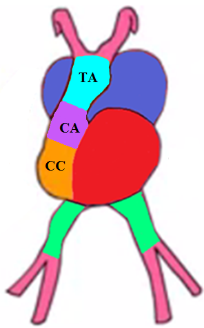 <p>Formed from the <strong><mark data-color="red">common ventricle</mark></strong> and the <strong><mark data-color="red">conus cordis</mark></strong></p>