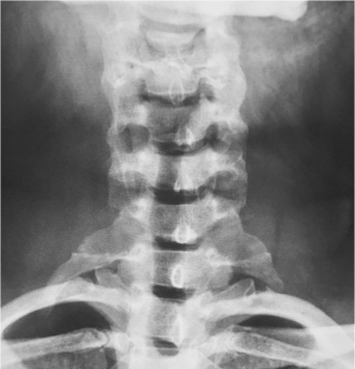 <p>State diagnosis</p>