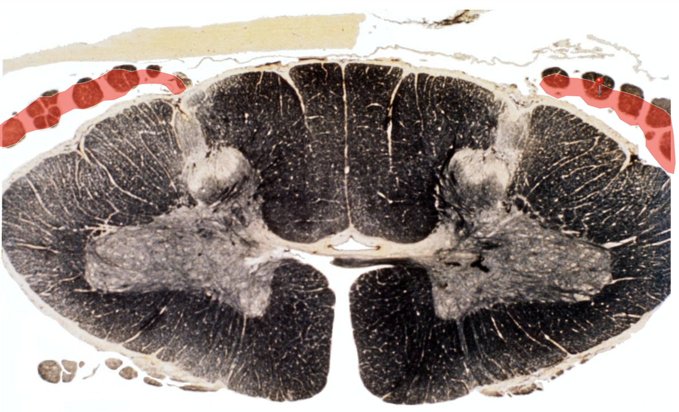 <p>Dorsal Root</p><p></p><p>Transport incoming primary sensory neurons </p>