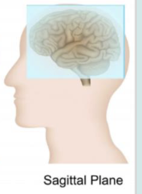 <p>Sagittal plane</p>