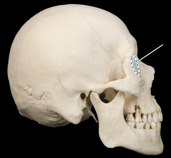 <p>Name this bone.</p><p>(Skull, lateral view).</p>