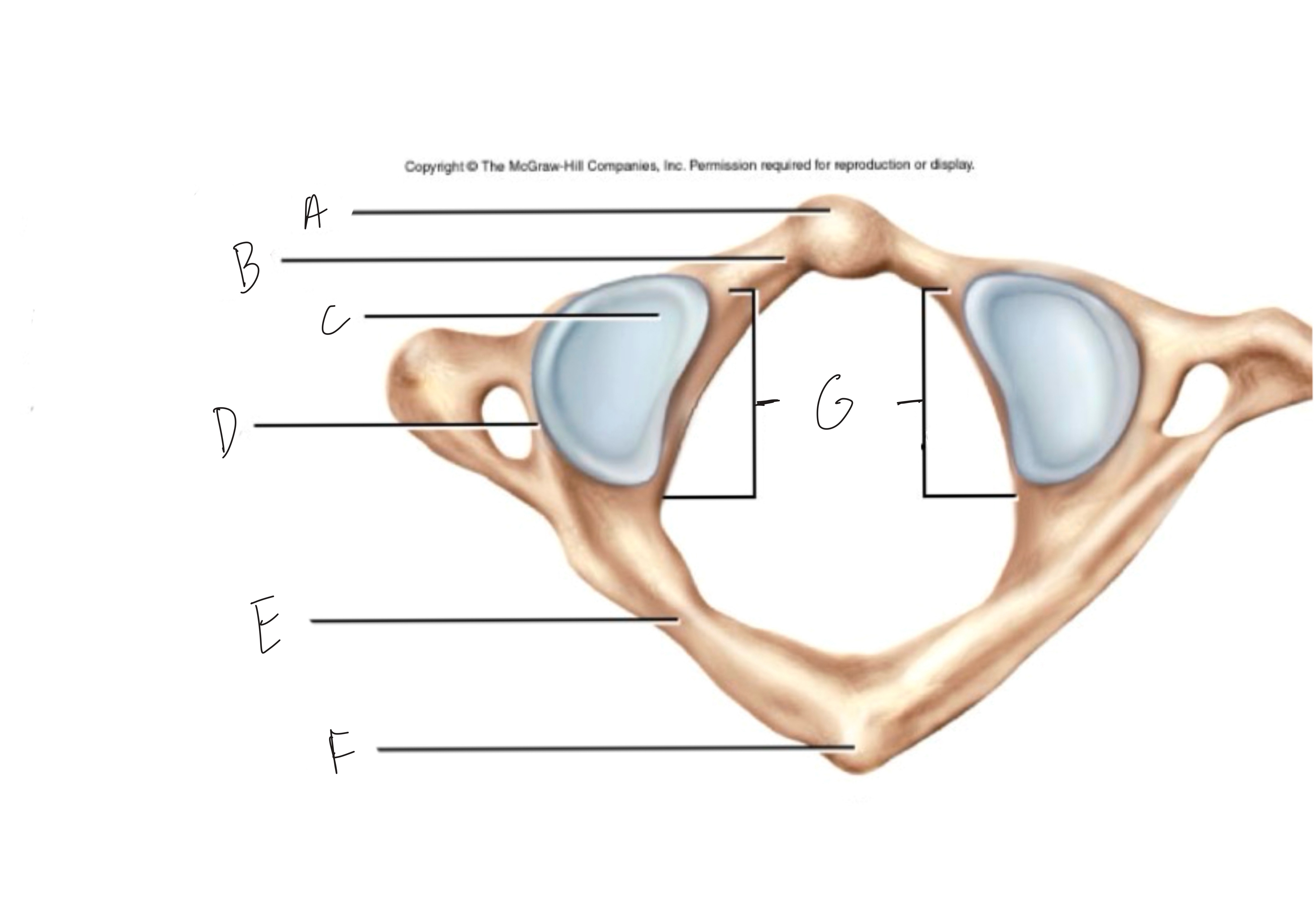 <p>What is “F” indicating?</p>