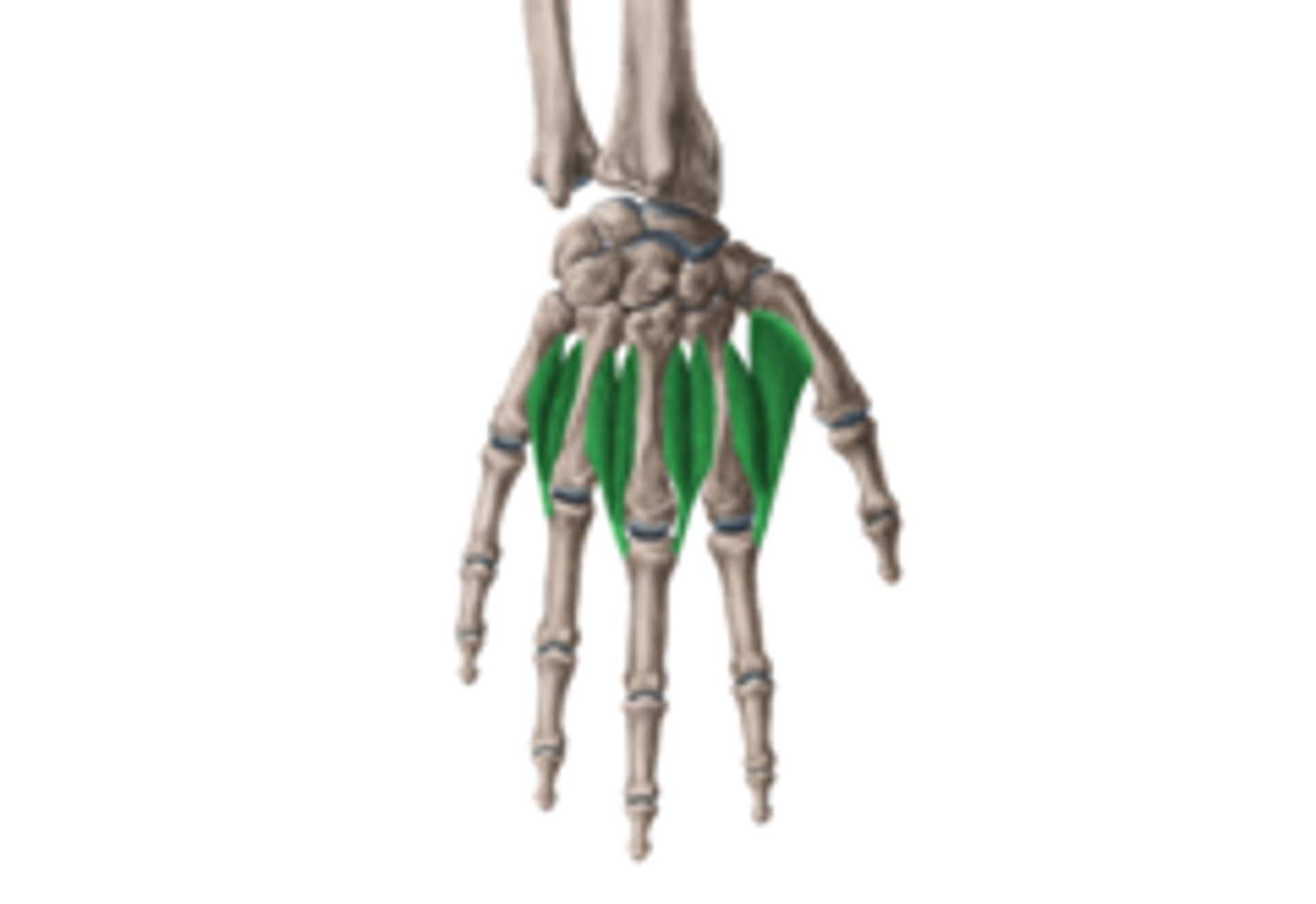 <p>Welke spier is dit?</p>