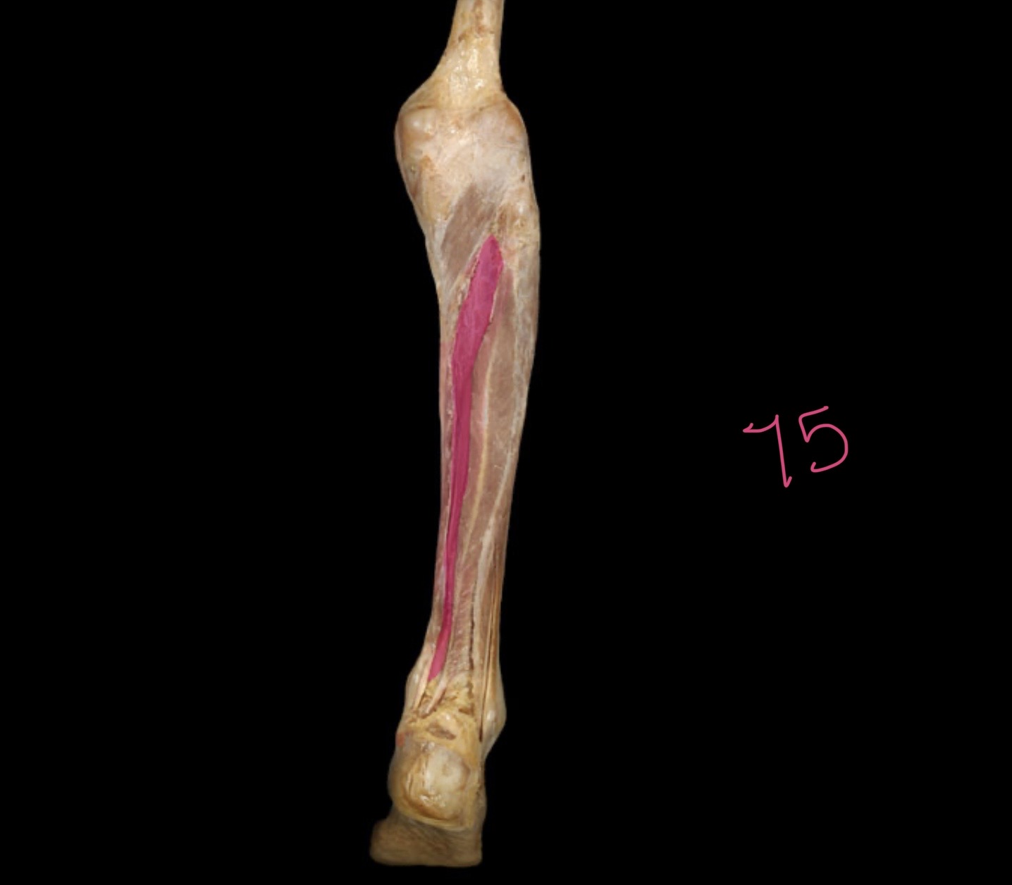 <p>Tibialis anterior</p>