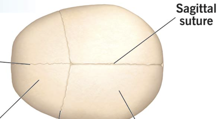 <p>Type of joint that appears as jagged lines where bones of skull meet</p>