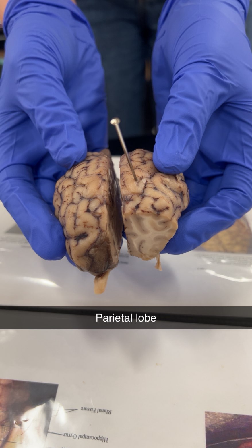 <p>parietal lobe</p>