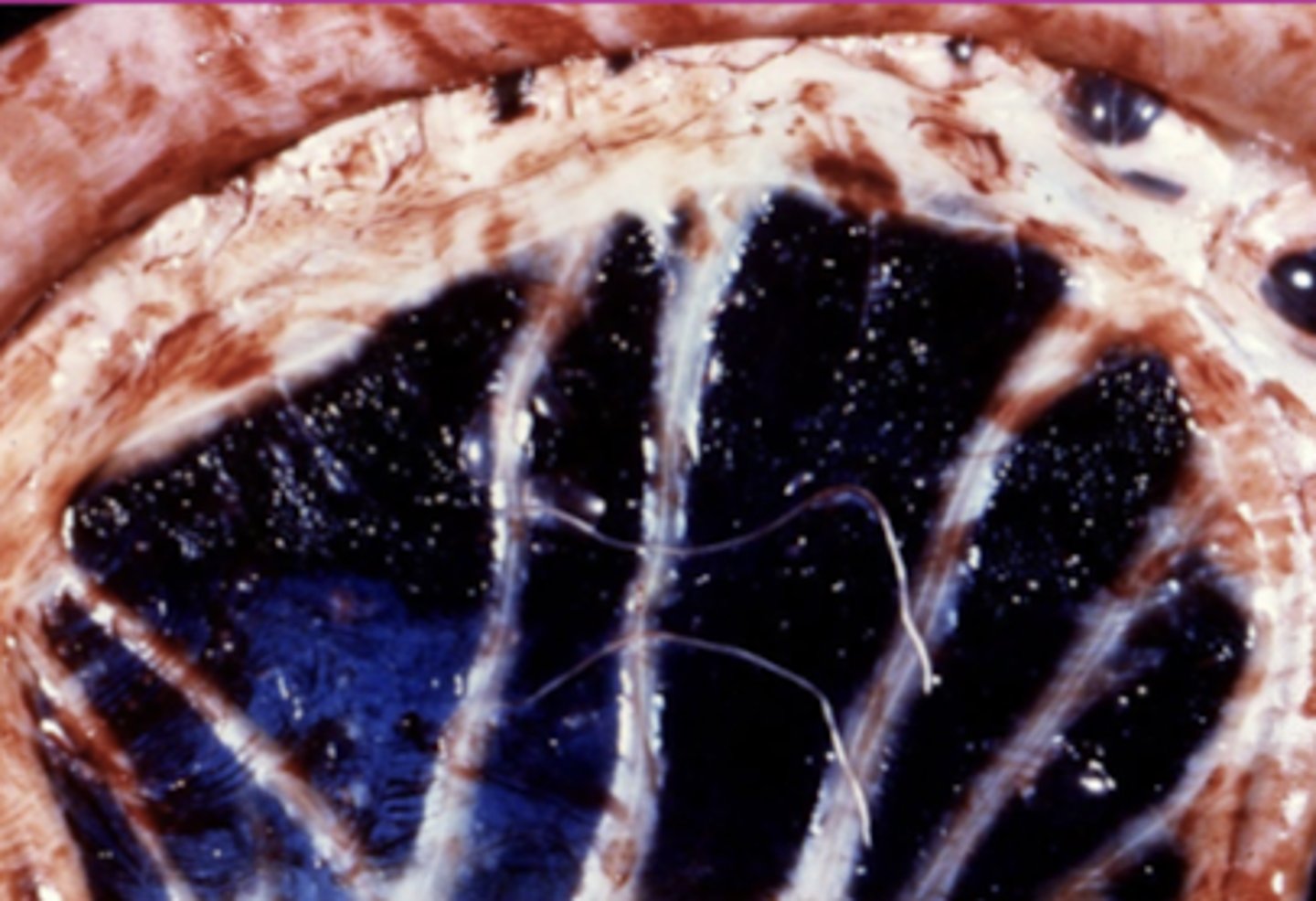 <p>what is this parasite in the peritoneum of a horse?</p>