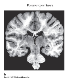 <p>• contains fibers related to pupillary light reflex</p>