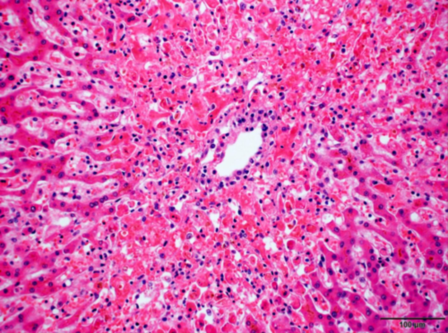<p>Centrilobular necrosis</p>