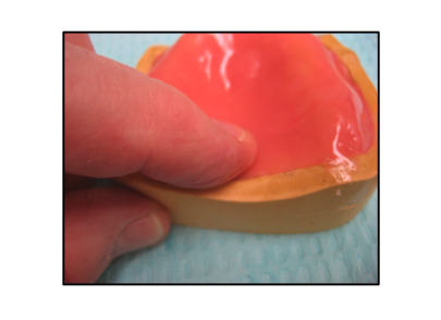 <p>When making the record bases, it is important to thin down the area posterior of the hard palate to be about __ mm wide. why do we do this?  </p>