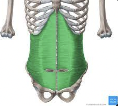 <p>What muscle is this?</p>