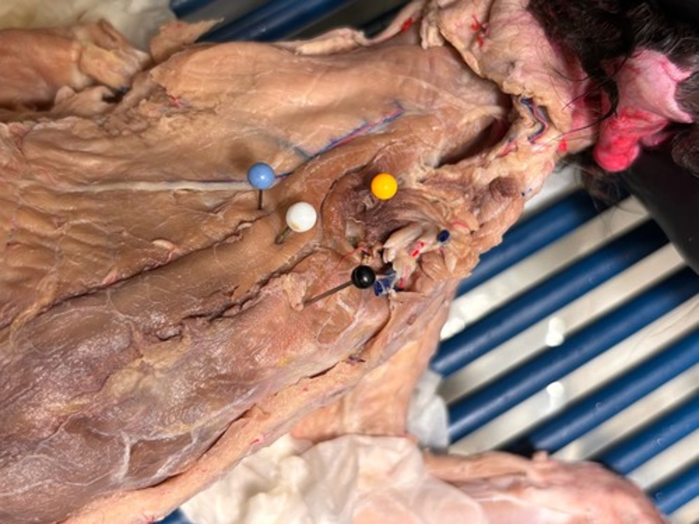 <p>What thoracic muscle is the light blue pin in</p>