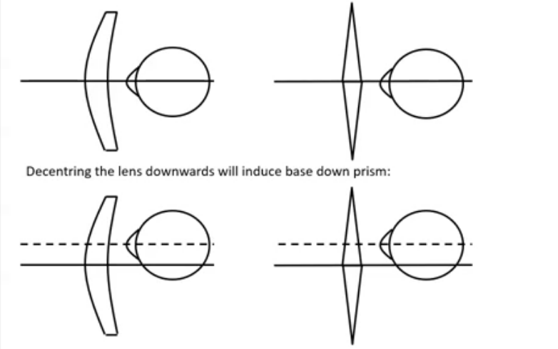 <p>decentering a positive power lens </p>