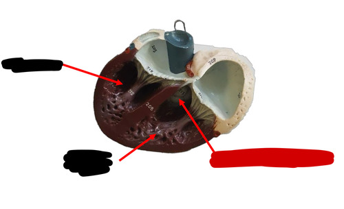 <p>Name this heart valve </p>