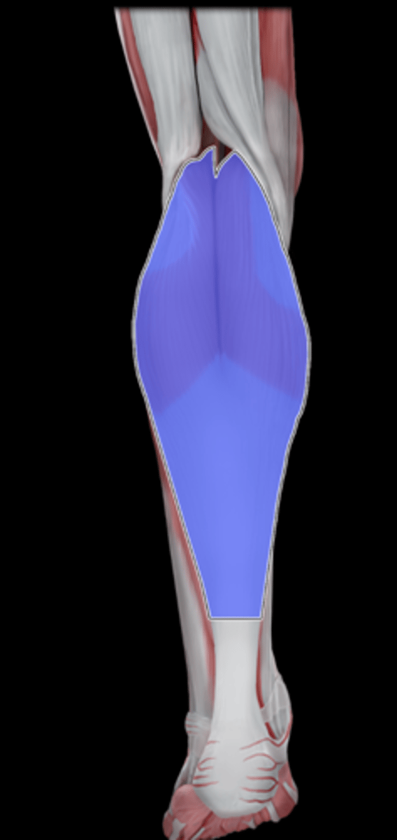 <p>What Muscle Is Highlighted?</p>