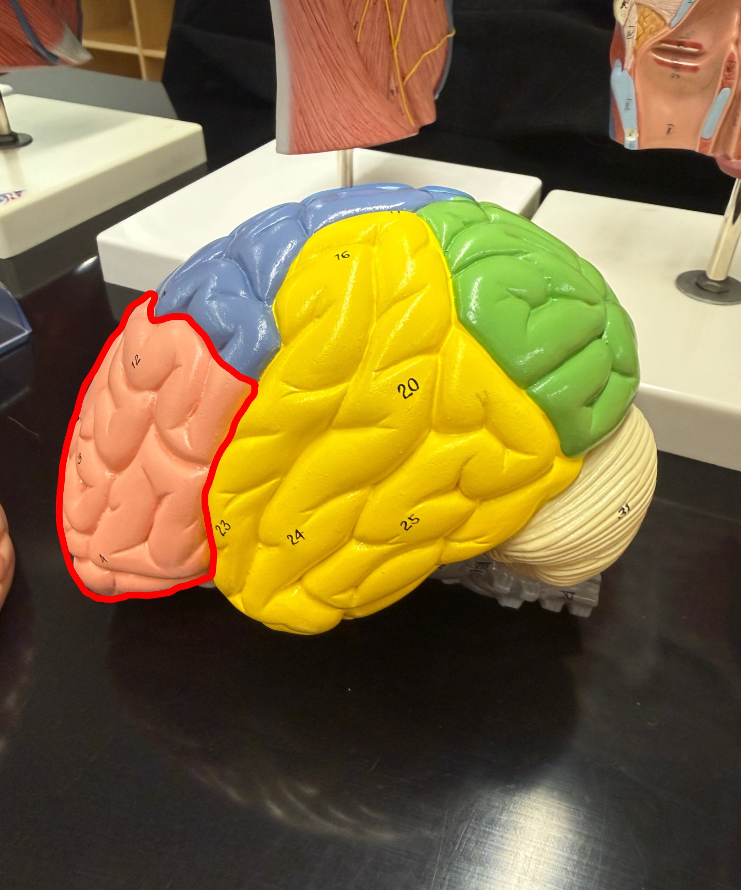 <p>What part of the brain is outlined in red? </p>