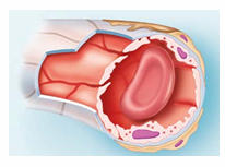 <p>Continuous Capillaries</p>