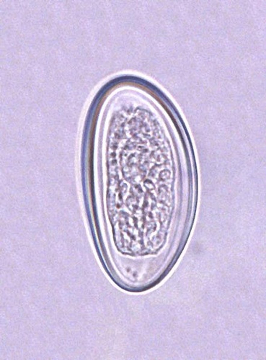 <p>PHASMID nematodes; D-shaped embryonated egg also known as PINWORM; collect specimen EARLY in morning; TAPE PREP is preferred for testing</p><p>MOT: ingestion of EMBRYONATED egg</p>