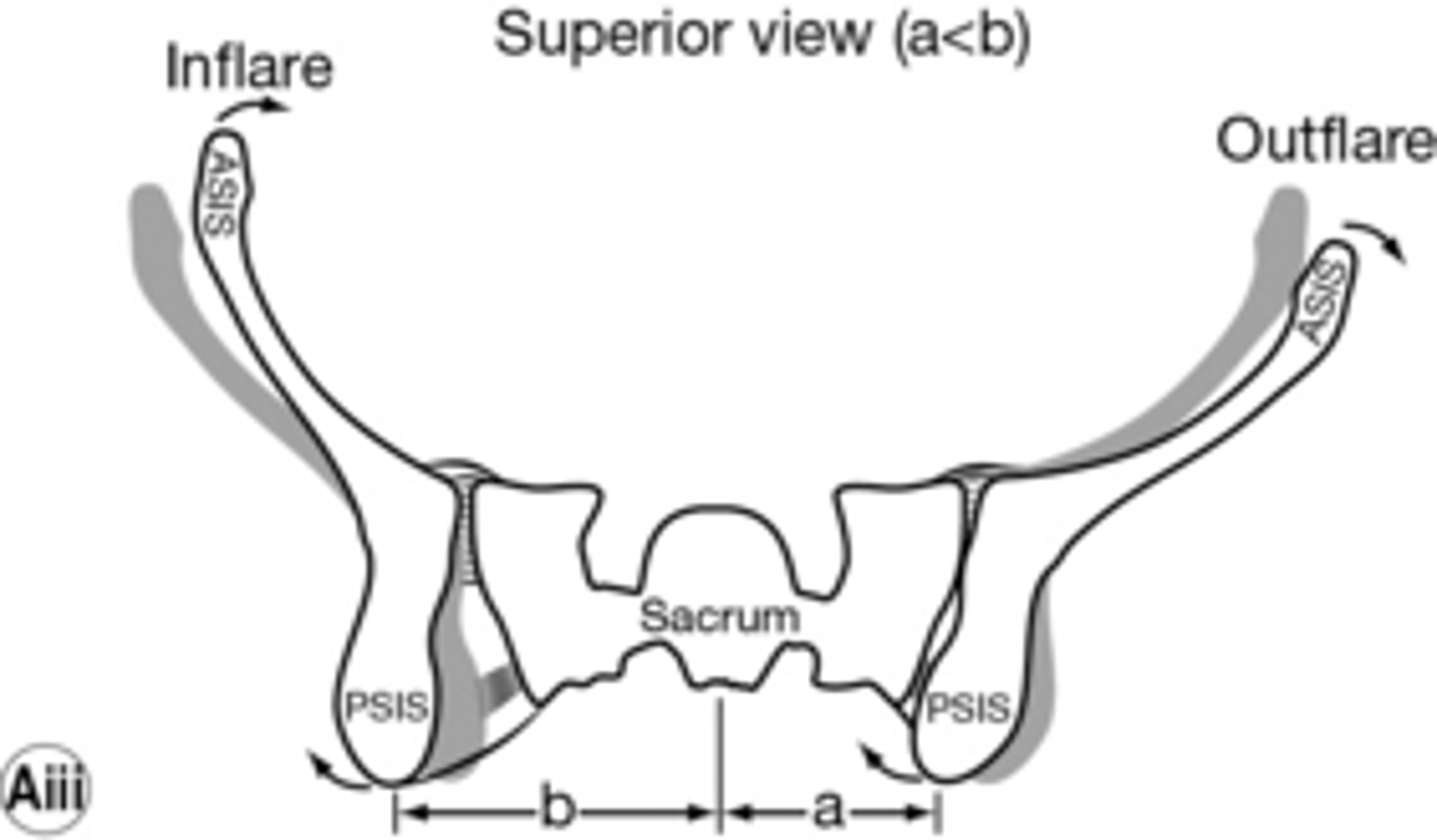 <p>ILIOSACRAL DYSFUNCTION</p><p>look at the distance from umbilicus to ASIS</p><p>out = greater</p><p>in = less</p>
