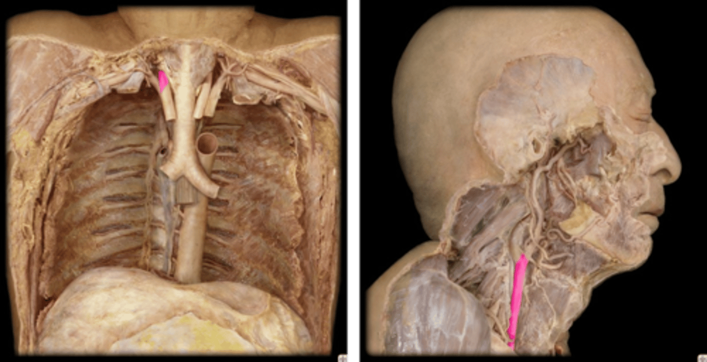 <p>Name this specific vessel (include the side).</p>