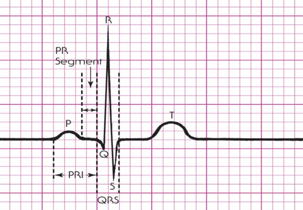 <ol><li><p>P Wave </p></li><li><p>PR Segment </p></li><li><p>PRI </p></li><li><p>QRS Complex </p></li><li><p>T Wave</p></li></ol><p></p>