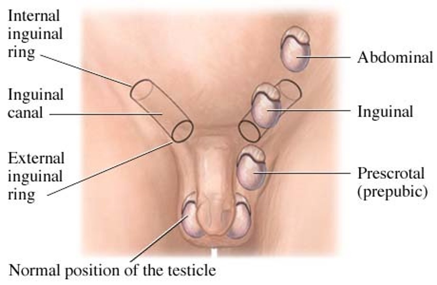 <p>inguinal canal</p>