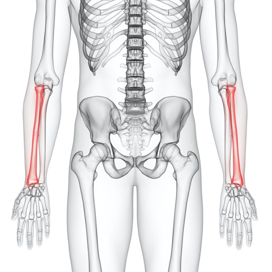 <p>Wat is hier aangeduid</p>
