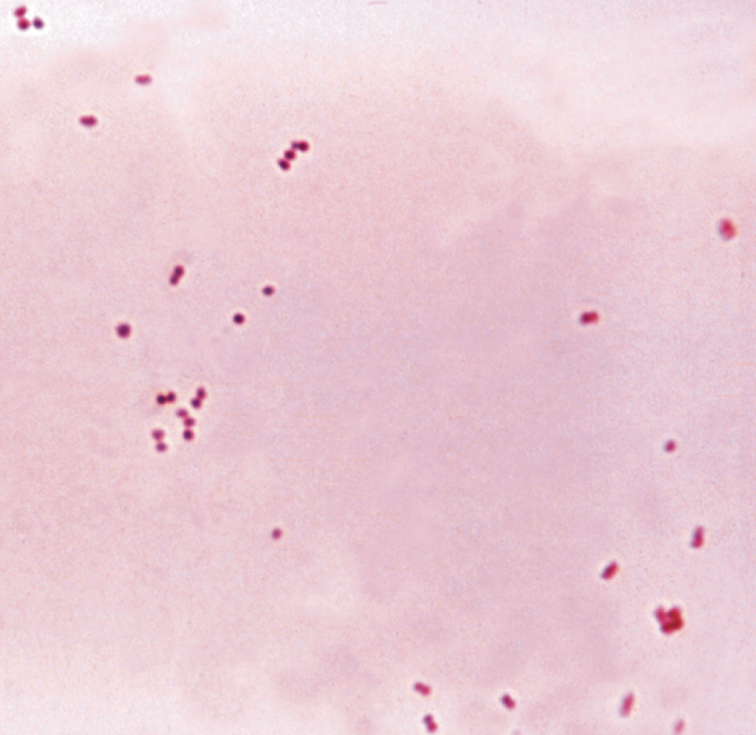 *Neisseria meningitidis*