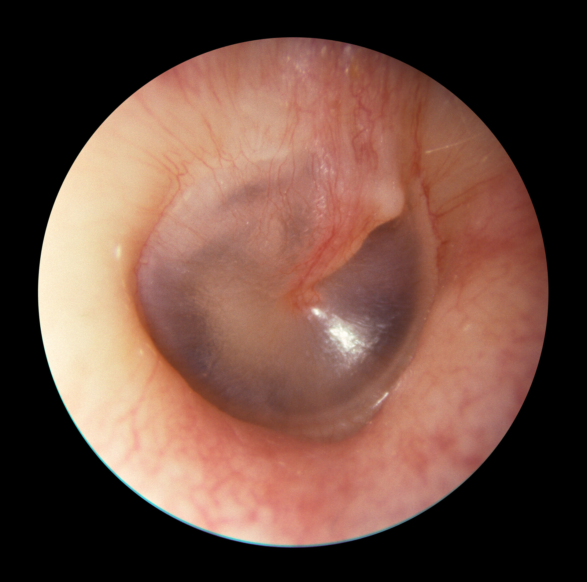 <p>thin, oval, semi-transparent membrane that separates the outer ear from the middle ear.</p>
