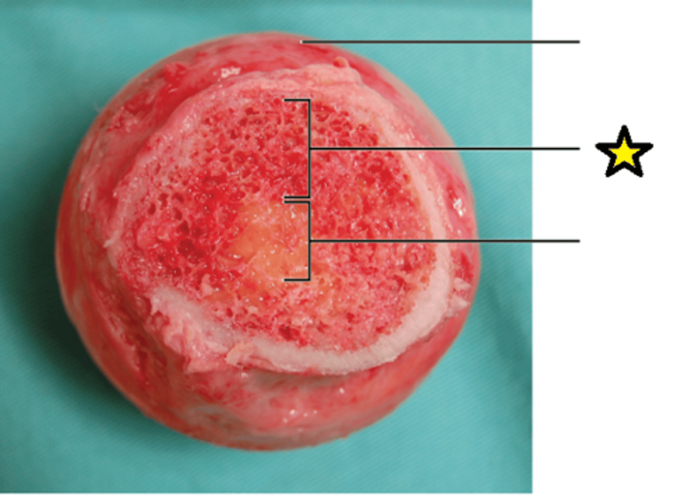 <p>Produces red blood cells.</p>
