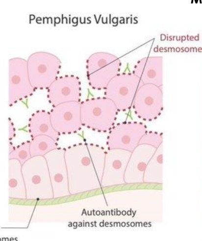 <p>What structure is targeted in <em>pemphigus</em>?</p>