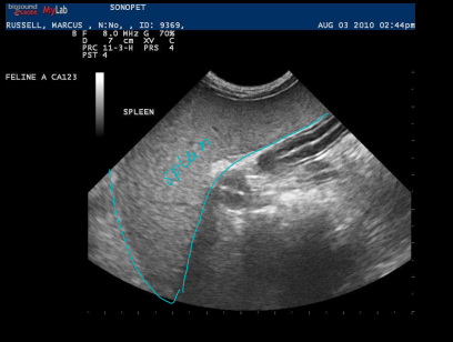 <p>Splenic Disease on Ultrasound</p>