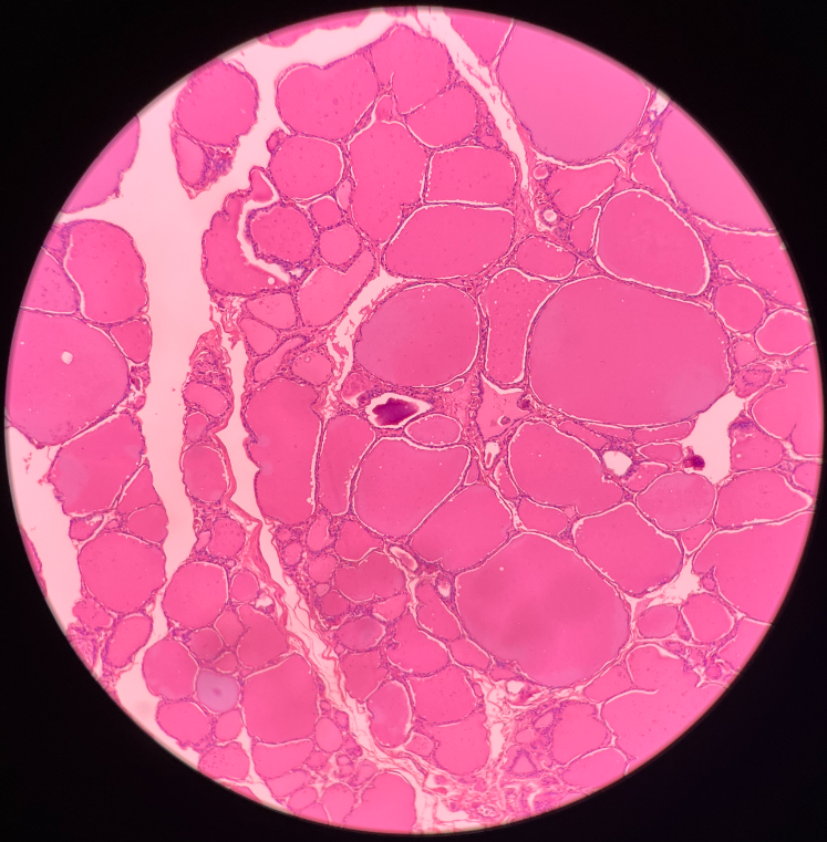 • Located in the anterior neck surrounding the trachea inferior to the larynx.

• Composed of butterfly-shaped right and left lobes connected by an isthmus.

• Composed of follicles.