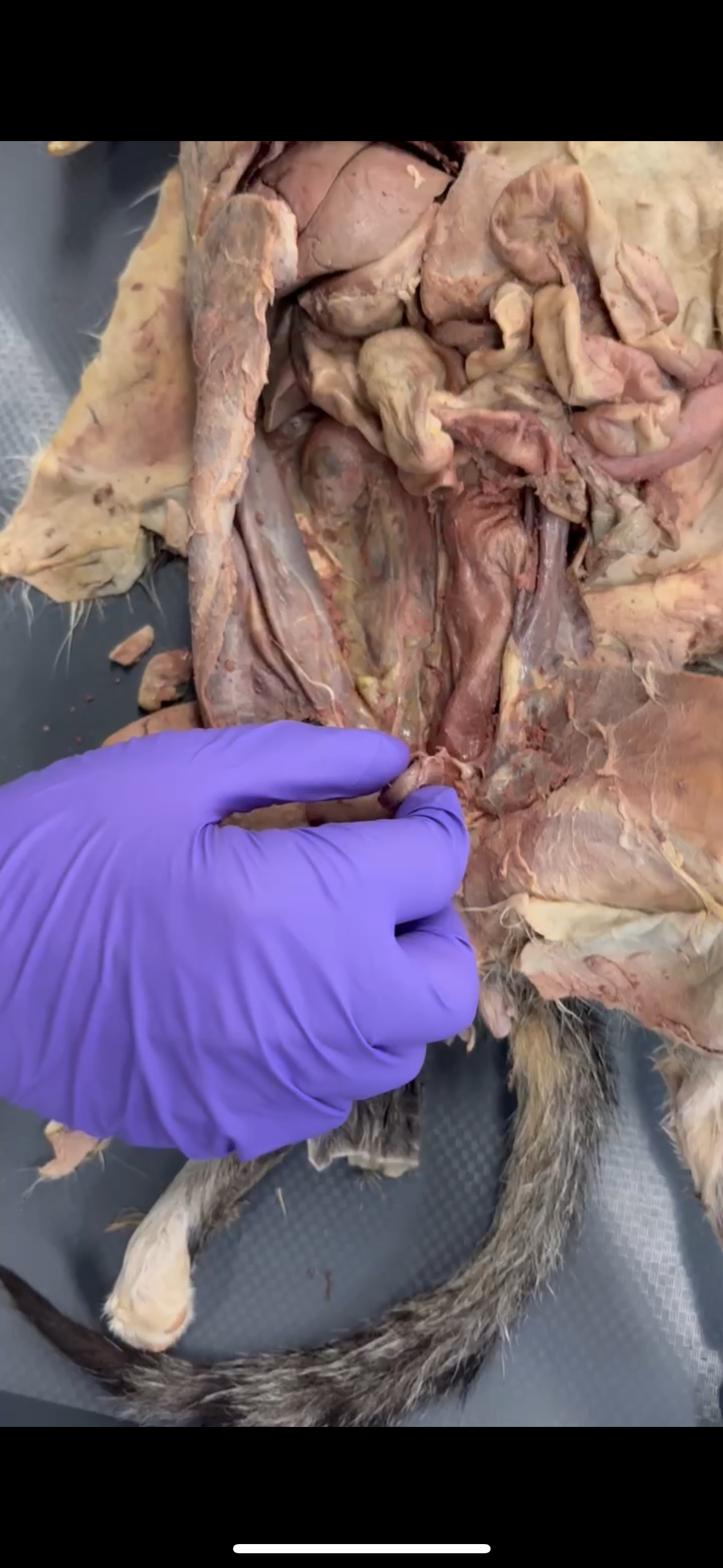 <p>What is being pinched</p>