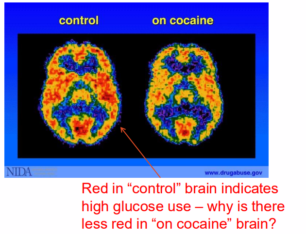 <p>- repeated or chronic use of mind-altering substances beyond therapeutic or social norms that may lead to drug addiction and overdose</p><p>- Addictive drugs can be very damaging</p><p>- experimental research has provided understanding of addiction and provided an avenue for understanding brain function</p>