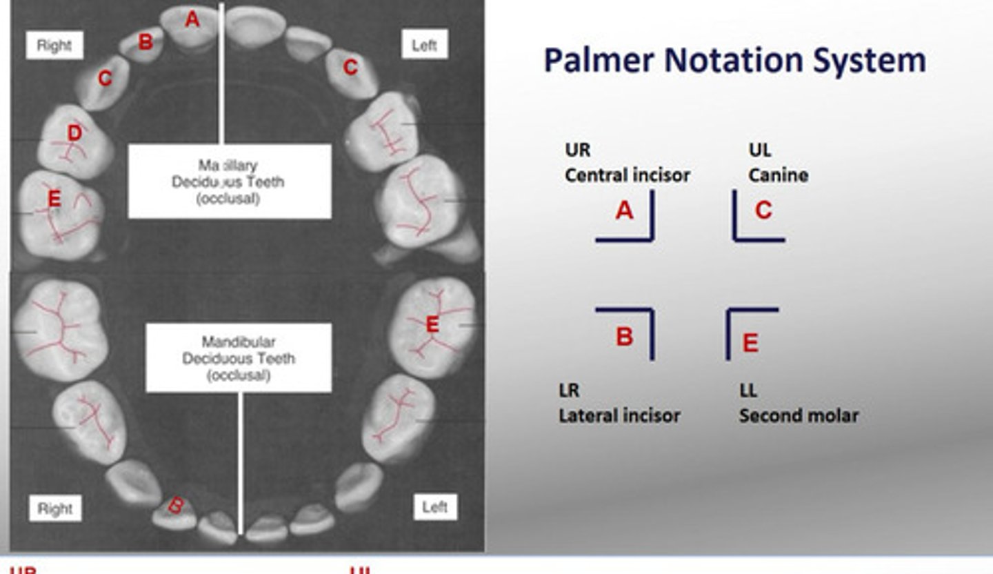 <p>uses letters A-E</p><p>Central incisors have the Letter A</p><p>Lateral incisors have the Letter B</p><p>Canines have the Letter C</p><p>First premolars have the Letter D</p><p>Second premolars have the letter E</p>