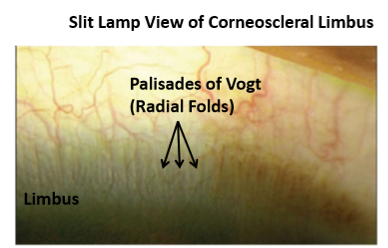 <p>Limbal stem cell population</p>