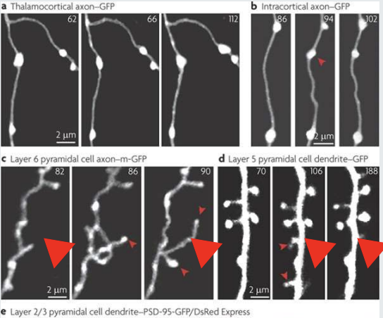 <p><strong>Results In</strong>:</p><ul><li><p>Subtle chemical changes at the synapse </p></li><li><p>Large-scale macrostructural changes detectable by MRI.</p></li><li><p>Transient or permanent irreversible changes, such as altered patterns of gene expression.</p></li></ul><p></p>