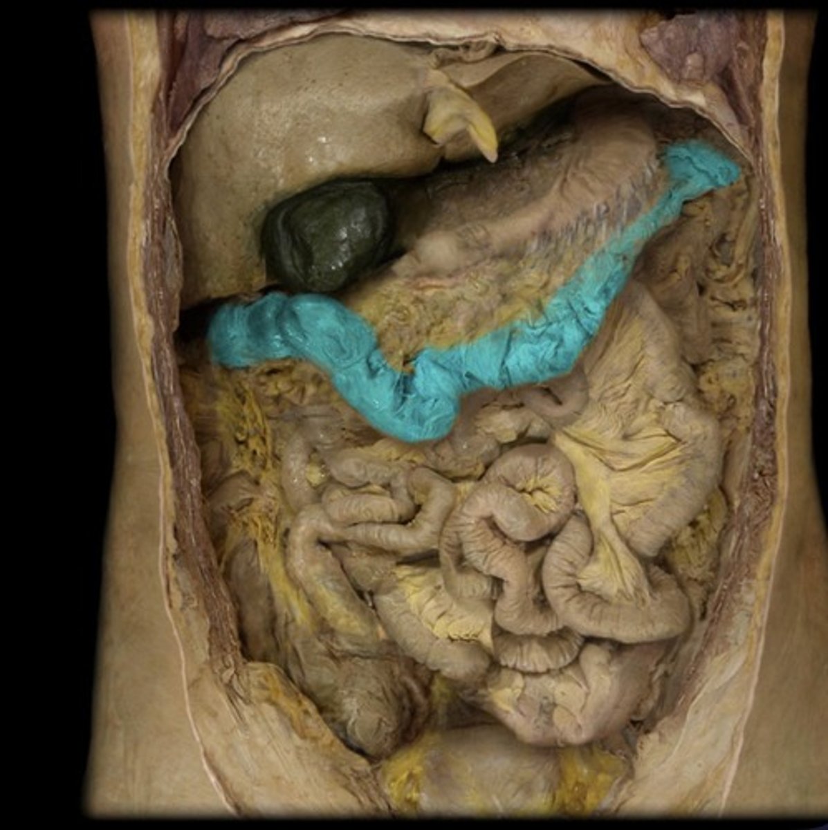 knowt flashcard image