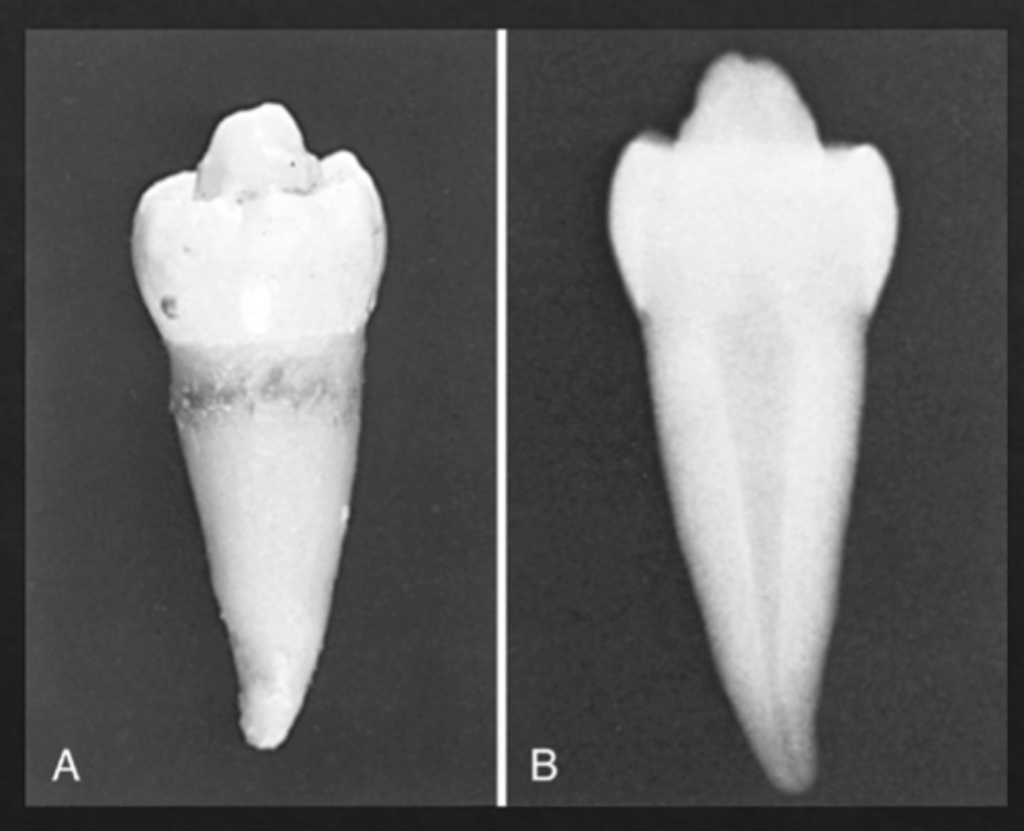<p>Enamel grows outward forming an extra cusp</p>