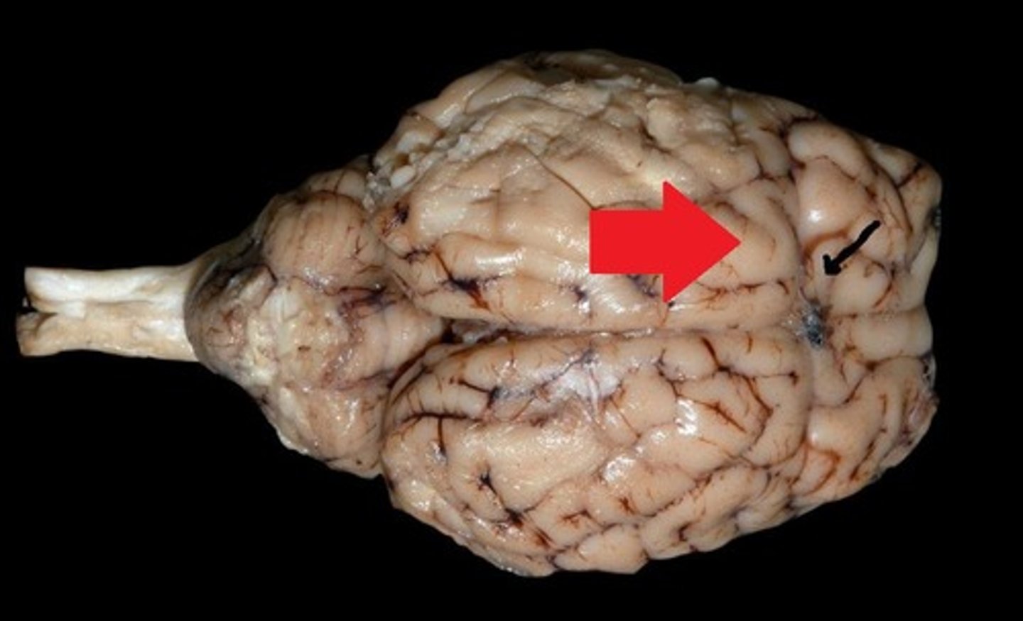 <p>the strip of parietal cortex, just behind the central sulcus, that receives somatosensory information from the entire body</p>