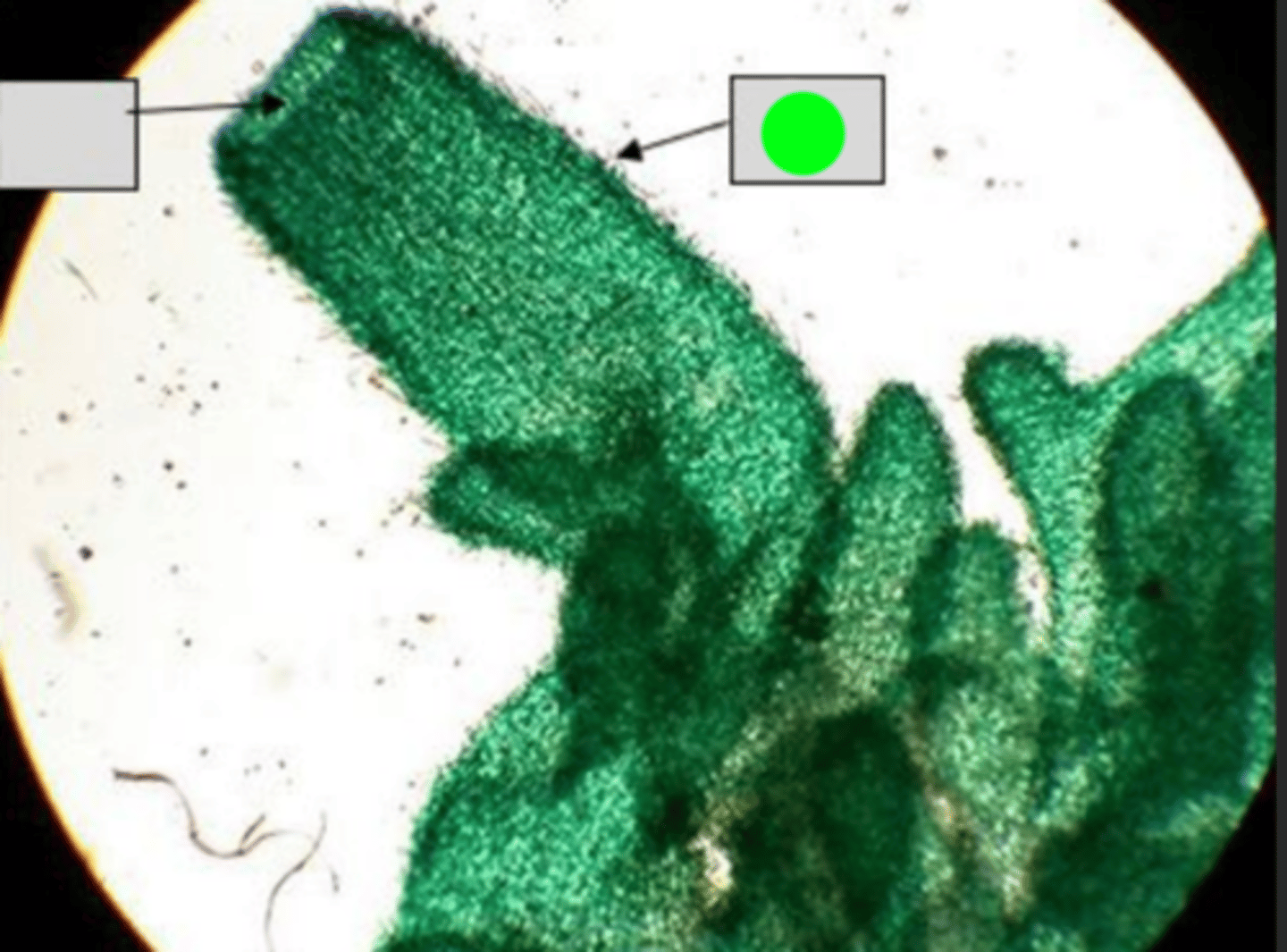 <p>Sharp, calcium carbonate structure in the mesohyl which form the skeletalfibers of the sponge (CaCO₃)</p>