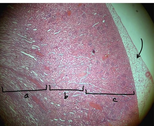 <p>specimen in the field of view?</p><p>region a?</p><p>region b?</p><p>region c?</p><p>layer at the tip of the arrow?</p>