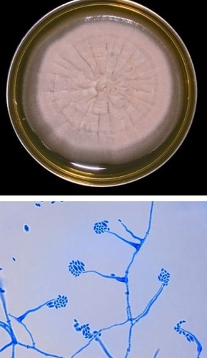 <p>• Gray, white, or pink</p><p>colonies</p><p>• Long, narrow,</p><p>unbranched phialides</p><p>with clusters of</p><p>microconidia</p>