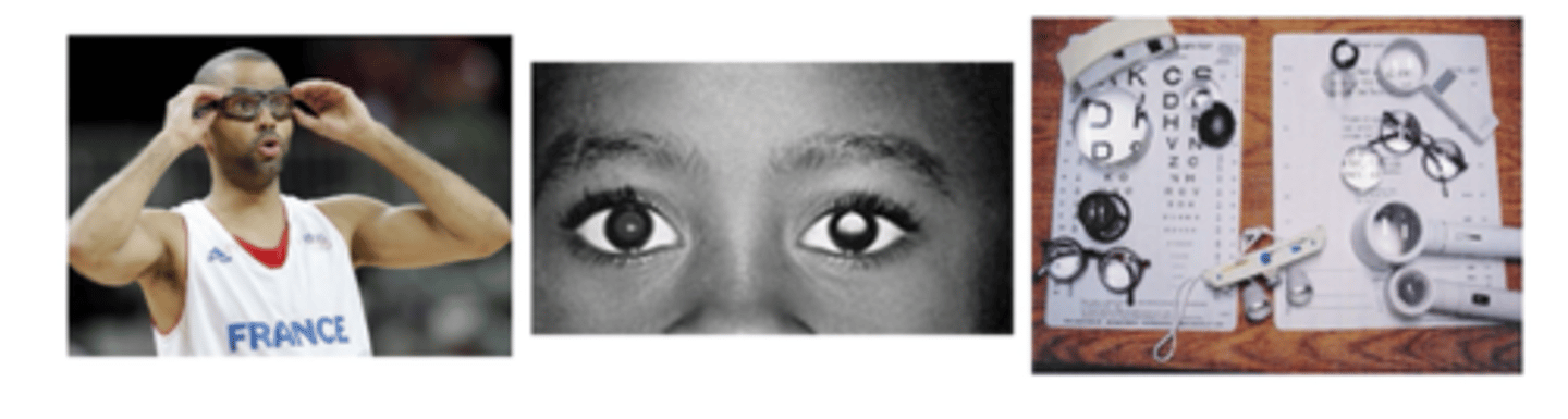 <p>primary = stop initiation of disease</p><p>secondary = early diagnosis of disease</p><p>tertiary = control the impact of disease</p>