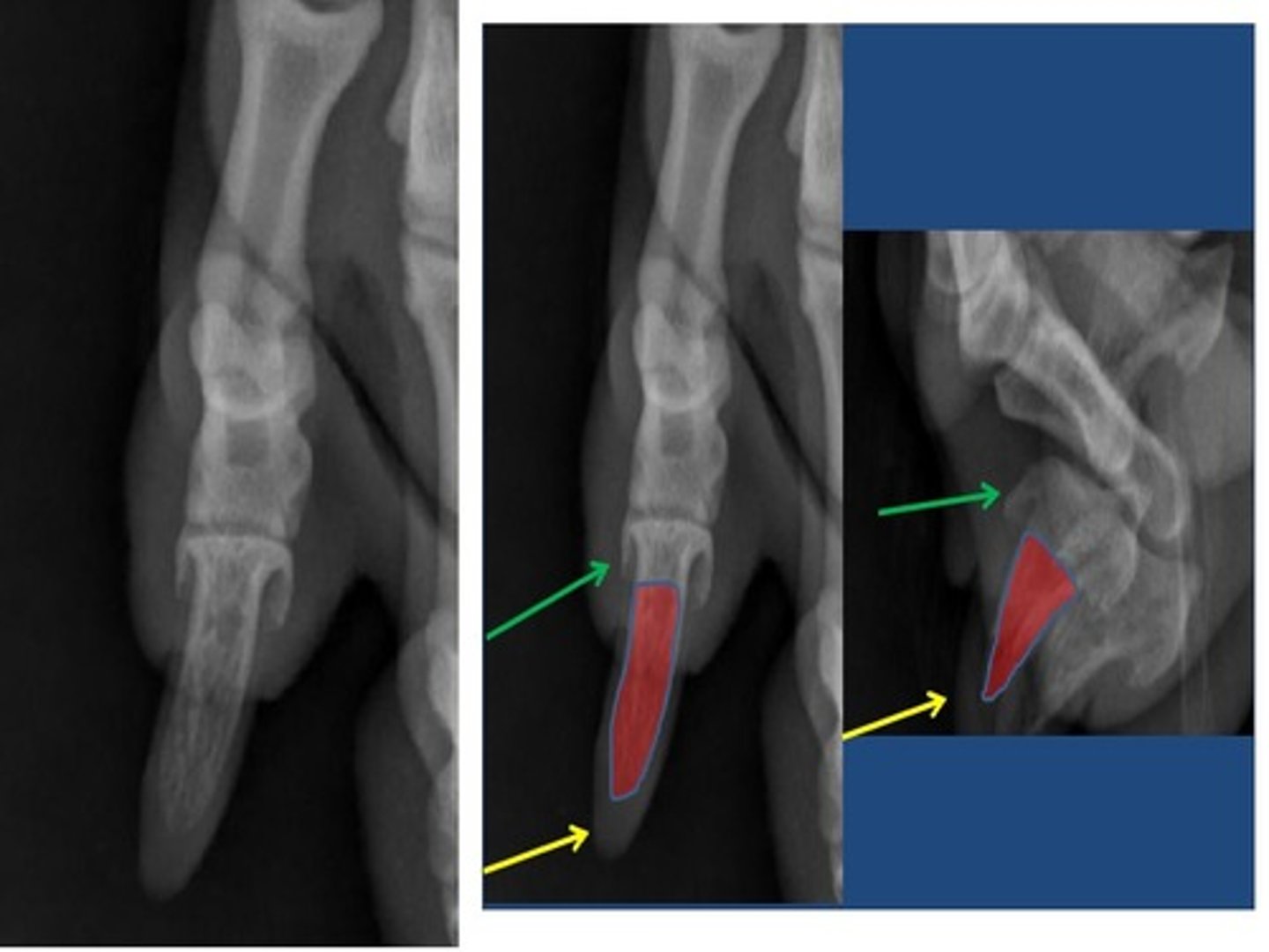 <p>a curved conical extension of the disatal phalanx into the claw</p>