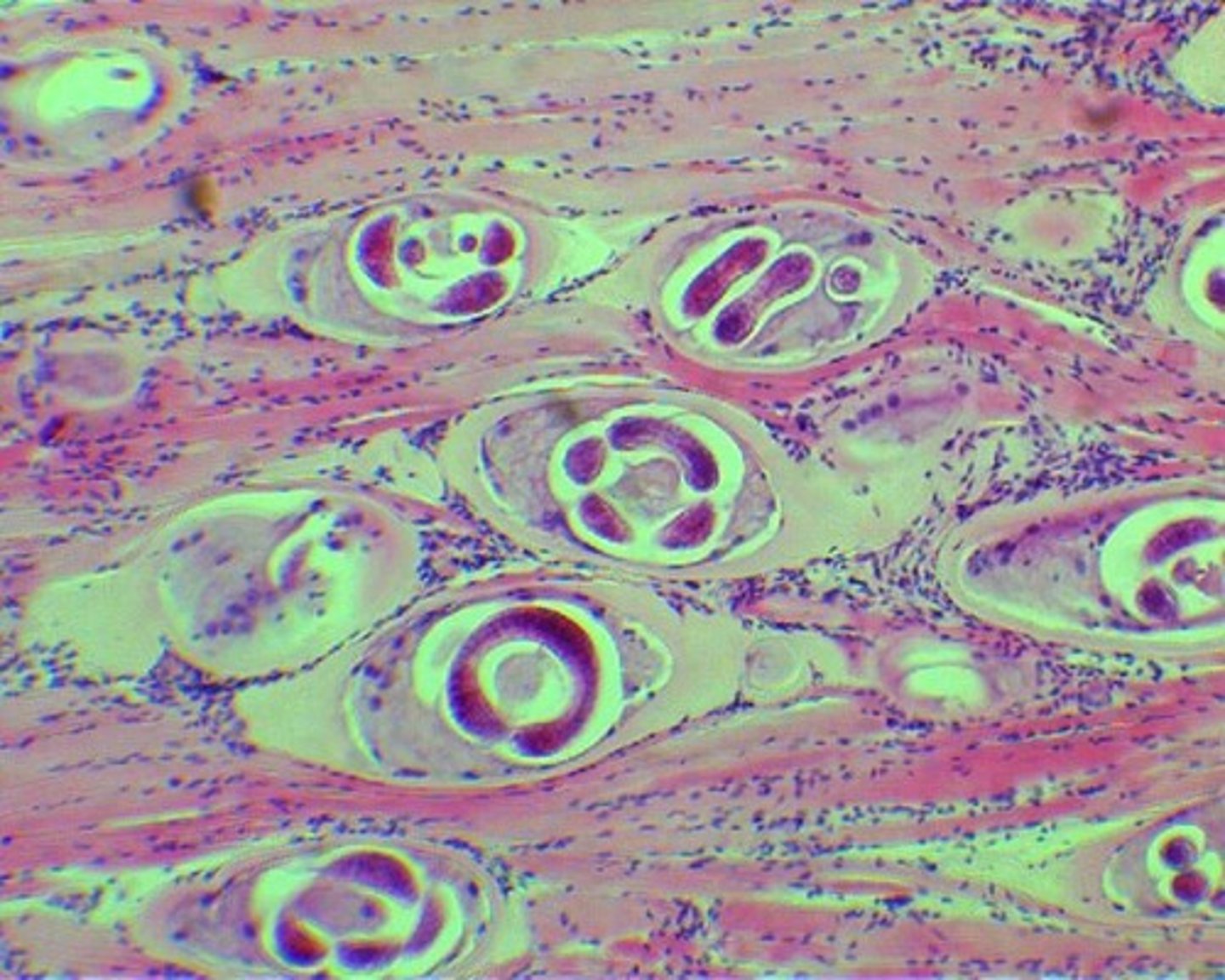 <p>Larval worm - Darker circles</p><p>Cyst - Part surrounding the larval worm</p>