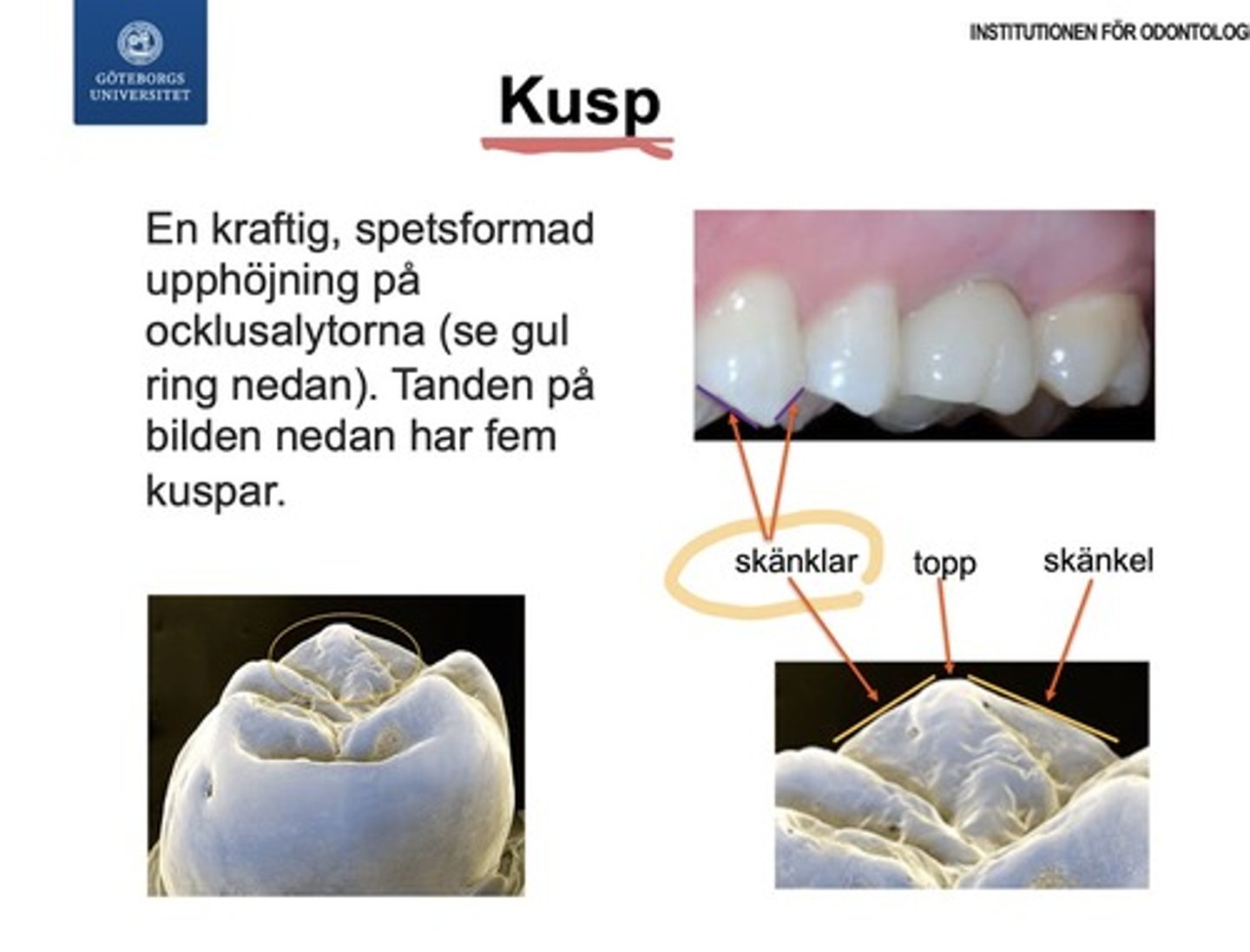 <p><span style="text-decoration:underline">En kraftig, massiv upphöjning på den ocklusala ytan.</span> </p><p>En tand kan ha flera kuspar, men incisiver saknar dessa helt. </p><p>Kuspen består av <strong>två skänklar</strong> ("uppförs/nedförs-backarna") och <strong>en topp</strong> samt <strong>kristor</strong></p>